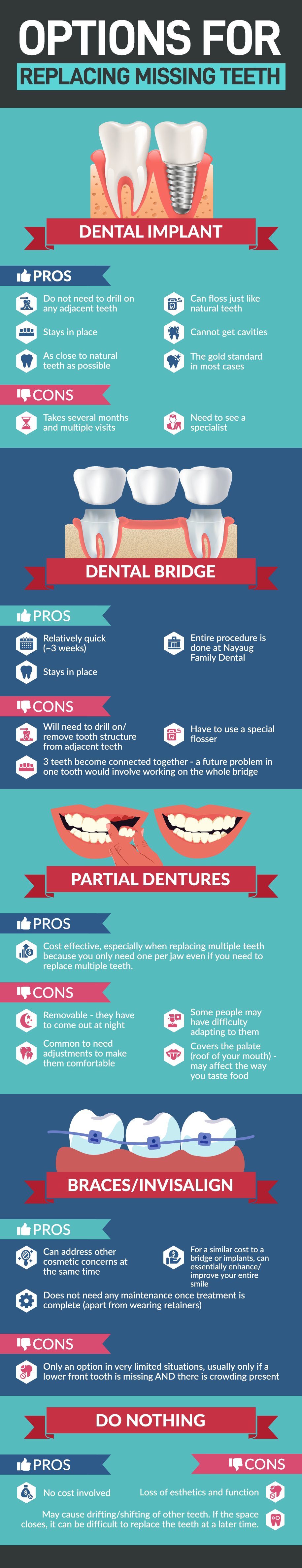 options-for-missing-teeth-infographic-1